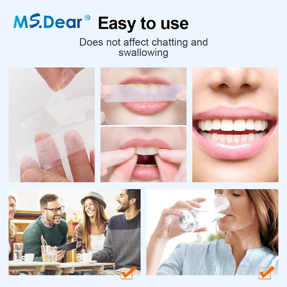 Craft Plus 9D Gel Teeth Whitening Strips package showing the whitening strips and branding on the box.